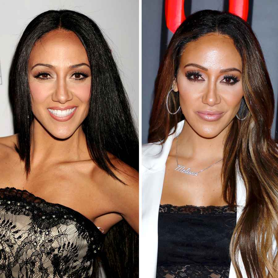 Melissa Gorga before and after plastic surgery